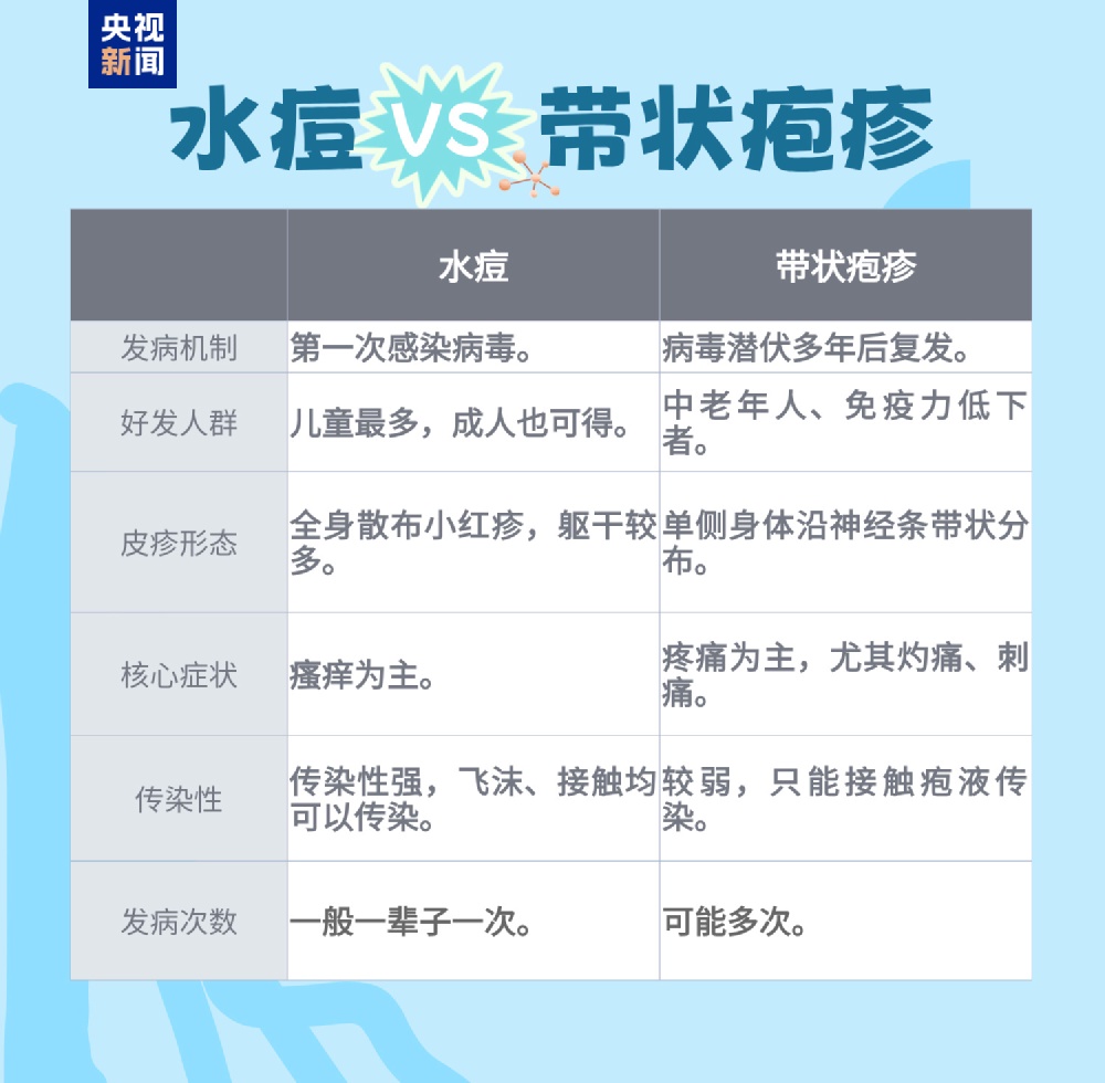 得过带状疱疹不等于终身免疫 一文讲清常见认识误区
